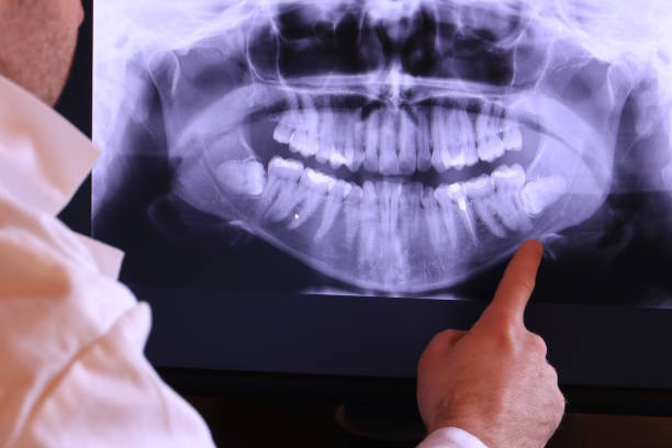 Best Urgent Dental Care for Toothaches in Haworth, NJ