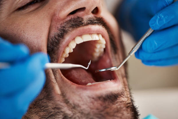 Best Emergency Care for Gum Disease in Haworth, NJ
